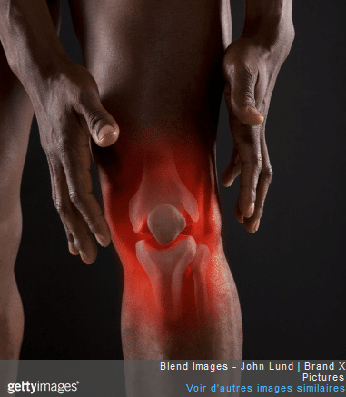 La pose d’une prothèse du genou entraîne une longue rééducation.